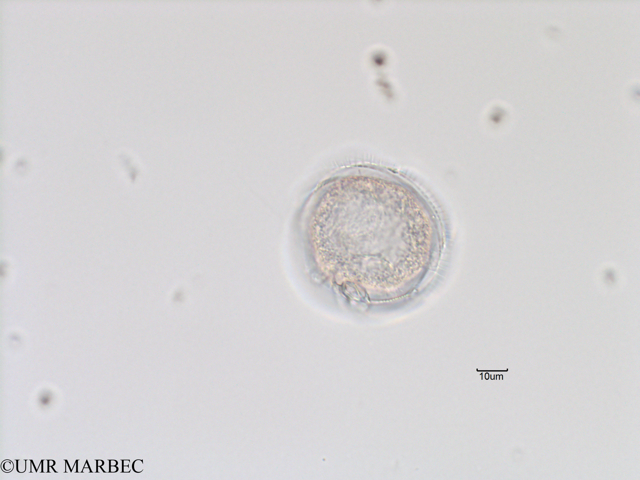 phyto/Bizerte/bizerte_bay/RISCO November 2015/Protoperidinium sp46 (Baie_T5-C3-dino avzc suture-5).tif(copy).jpg